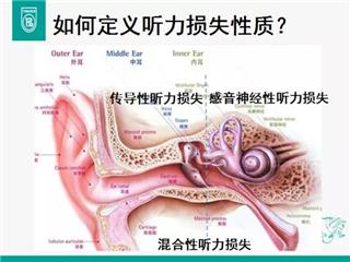 家长一巴掌 可能会导致孩子 意外 致聋