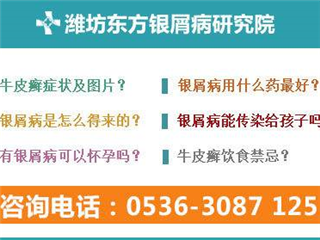 养生保健：比潍坊银屑病医院专业根治牛皮癣