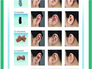 宜声听力