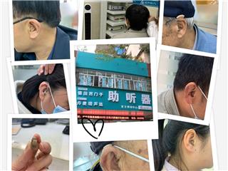 安庆宜声听力