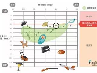 安庆的助听器用户您知道什么是迟发性听力剥夺吗？ 