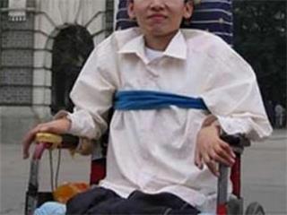 肌营养不良